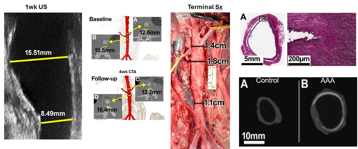 Endovascular swine aneurysm model shown by one-week ultrasound, baseline and four-week CT angiography, terminal surgery, histology, and micro-CT comparison of control and aneurysmal aorta.